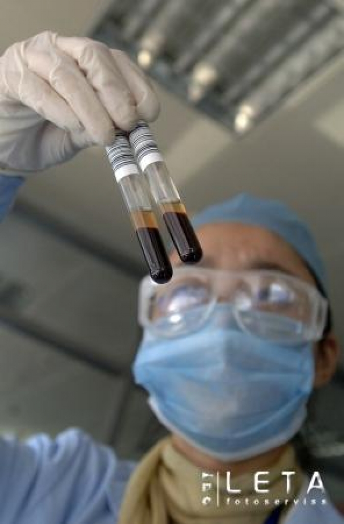  Laboratorijas darbinieks 6.novembrī Hefeijas pilsētā Ķīnas Anhojas provincē veic HIV un AIDS izmeklējumus asins paraugos.
Autors: AFP/LETA